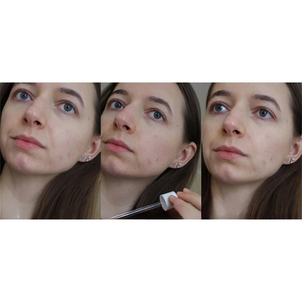 آمپول التیام بخش سنتلا ماداگاسکار اسکین 1004 SKIN1004 Madagascar Centella Ampoule